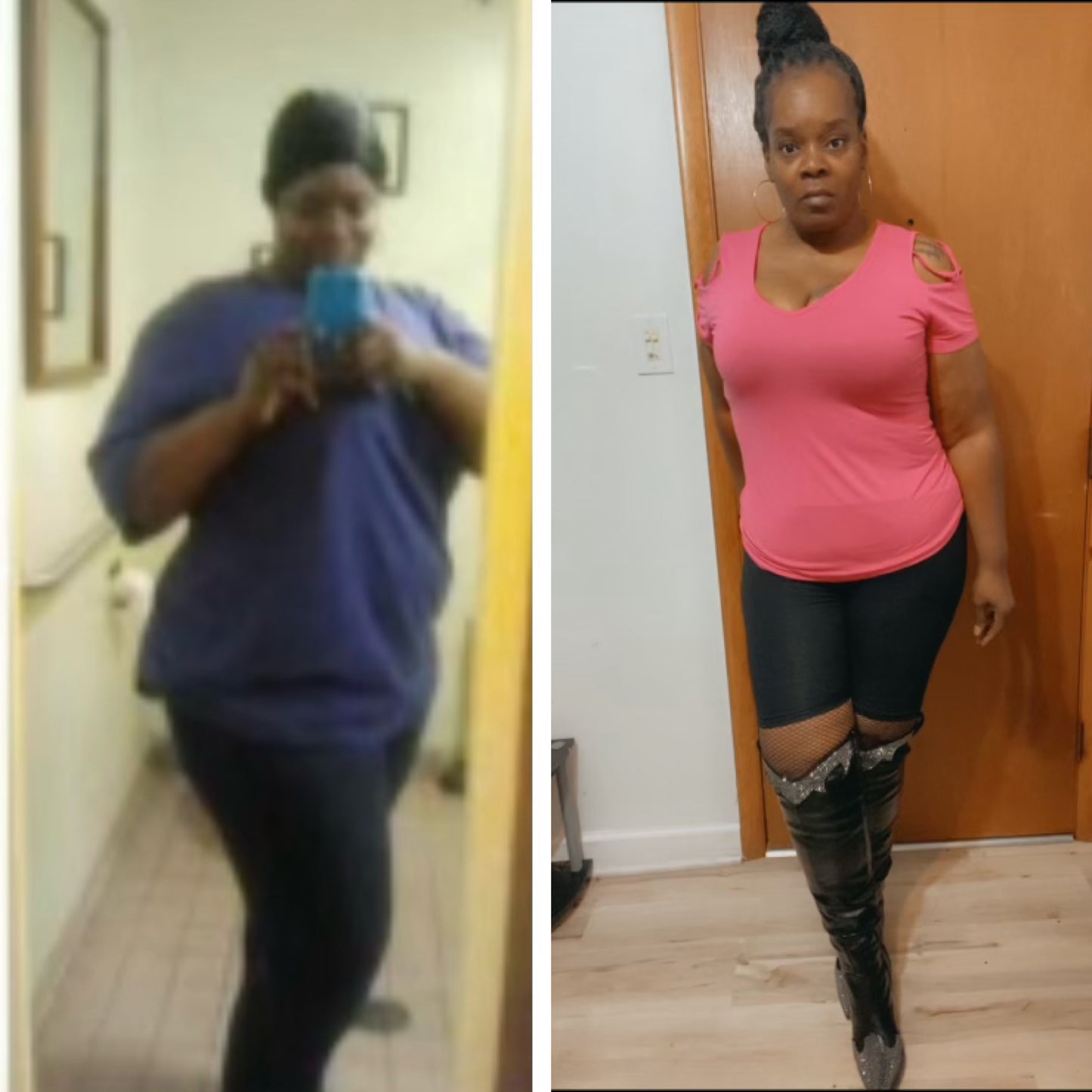 Tirzepatide/Weight Loss